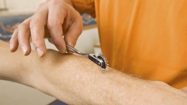 Man Receiving Nerve Damage Treatment Stock Photo